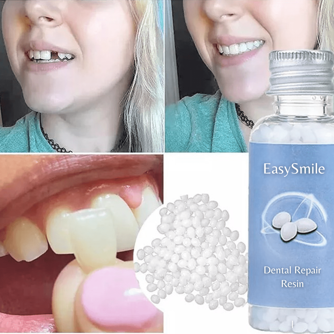EasySmile - Dental Repair Resin