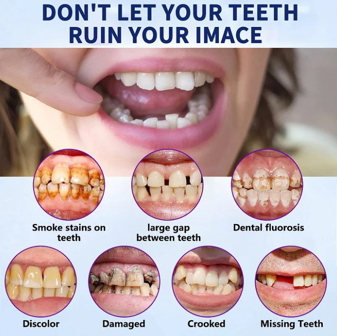 EverSmile™ Teeth Veneers