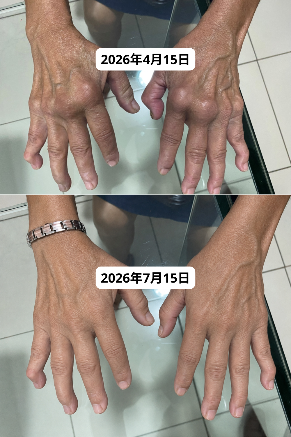 田中 美智子さん - 52歳