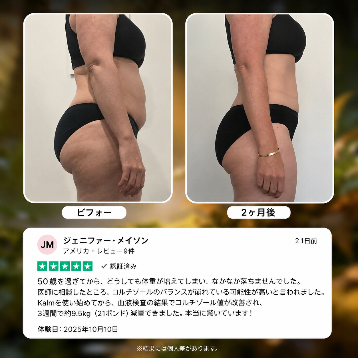 KALMブレスレット | 自然な体重管理をサポート